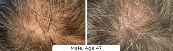 Hair Growth Shampoo - Image 3