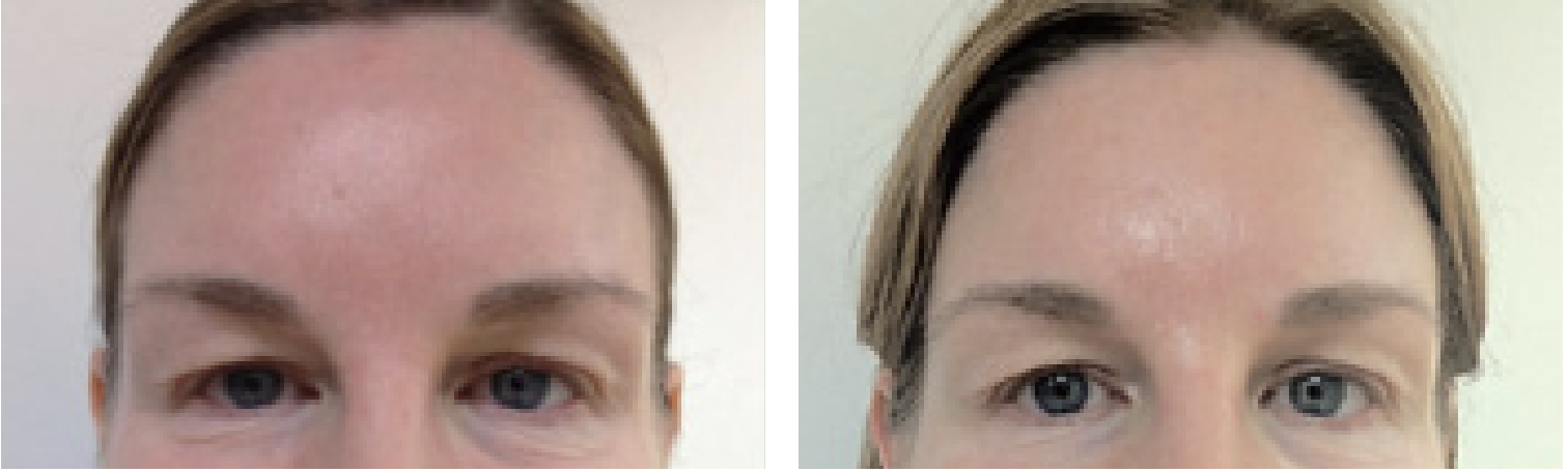 Mattifying Green Tea Serum - Image 3