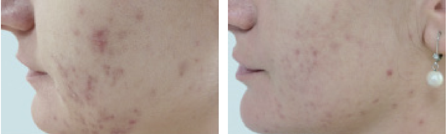 Mattifying Green Tea Serum - Image 2